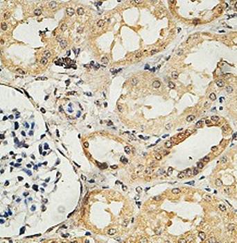 HYI Rabbit Polyclonal Antibody