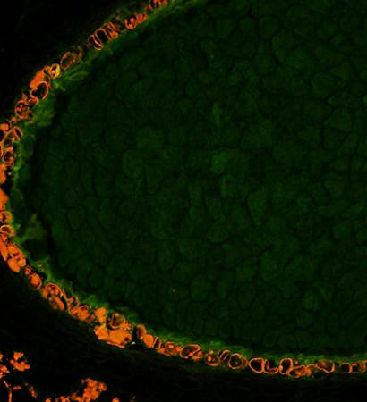 IAA Rabbit Polyclonal Antibody