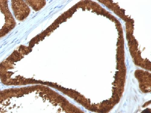 IDH1 Antibody