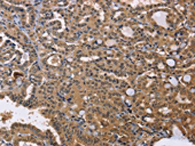 IDH1 Antibody
