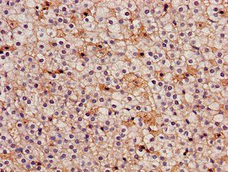 IDH3A Antibody