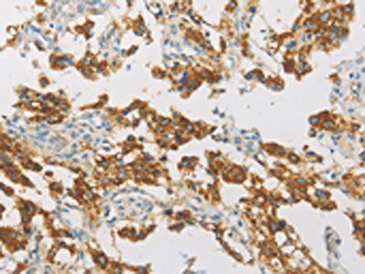 IDH3G Antibody