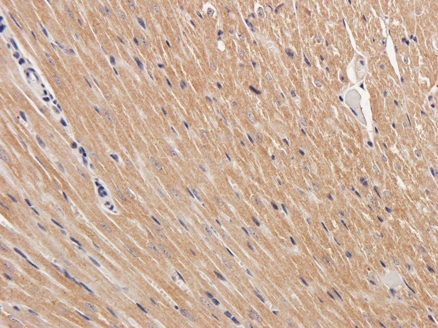 IDHP Rabbit Polyclonal Antibody