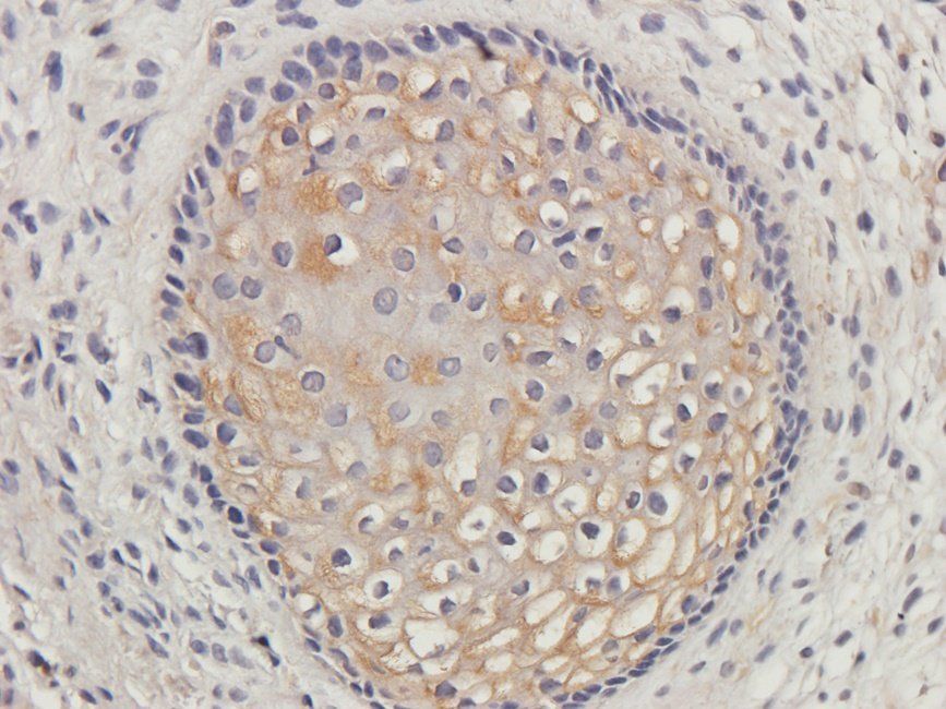 IDHP Rabbit Polyclonal Antibody