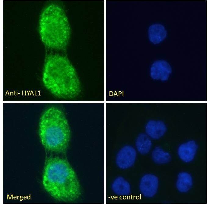 Hyaluronidase 1 Antibody