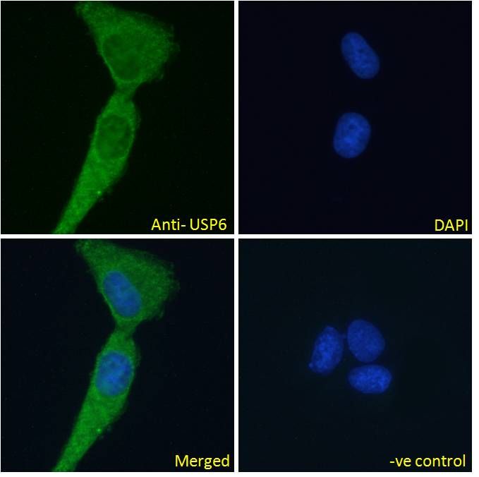 Goat anti-USP6 (aa142-155) Antibody