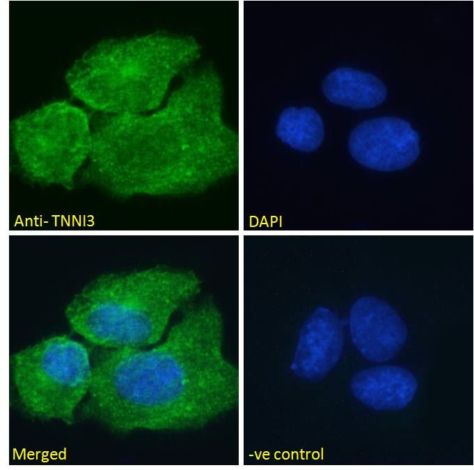 TNNI3 (aa117-127) Antibody