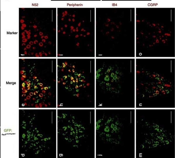 GOAT ANTI RAT CALCITONIN GENE-RELATED PEPTIDE