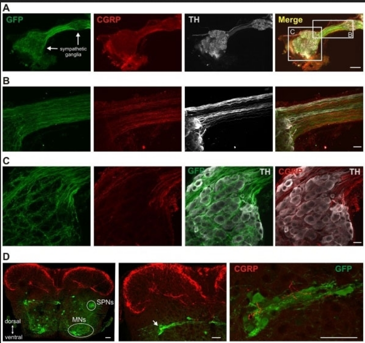 GOAT ANTI RAT CALCITONIN GENE-RELATED PEPTIDE