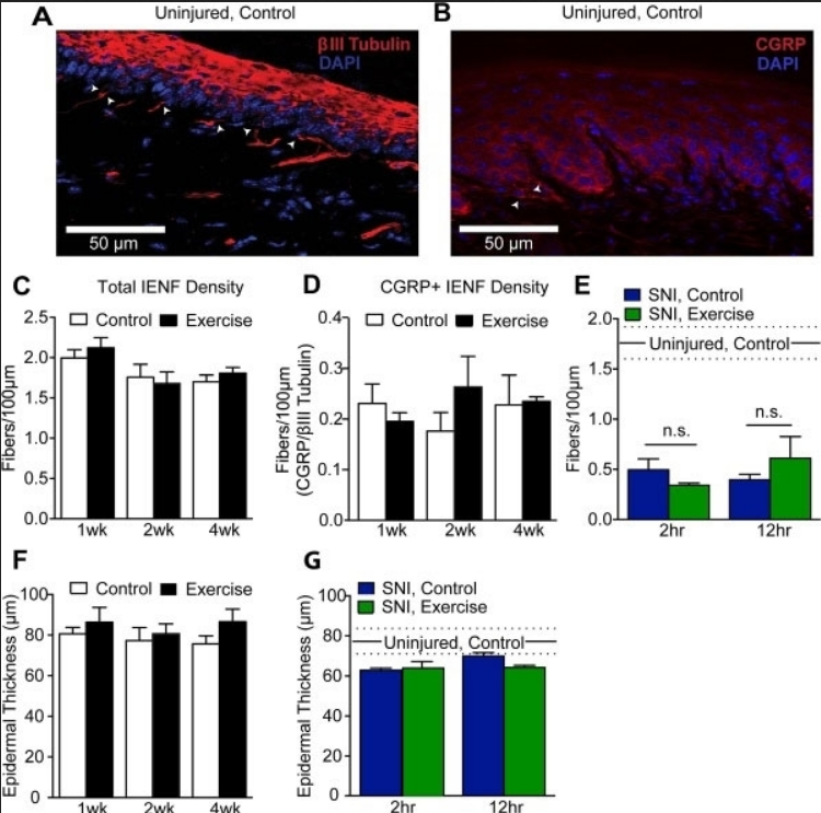 GOAT ANTI RAT CALCITONIN GENE-RELATED PEPTIDE