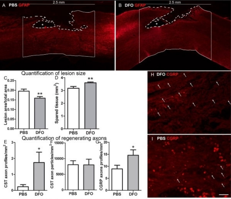 GOAT ANTI RAT CALCITONIN GENE-RELATED PEPTIDE