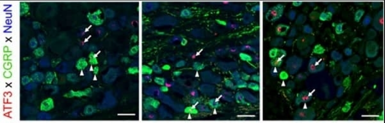 GOAT ANTI RAT CALCITONIN GENE-RELATED PEPTIDE