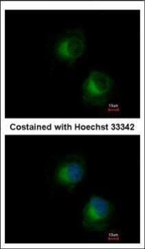 IFIT3 Rabbit Polyclonal Antibody