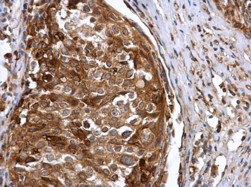 IFIT3 Rabbit Polyclonal Antibody