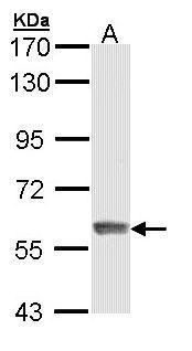 IFIT3 Rabbit Polyclonal Antibody