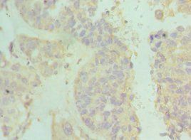 IFNAR2 Antibody