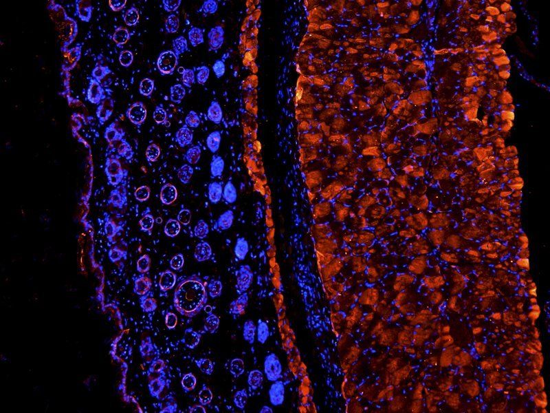 IGF1 antibody