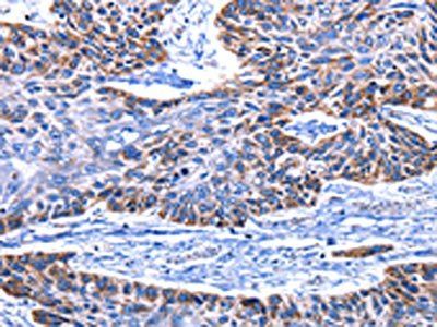 IGF2BP2 Antibody