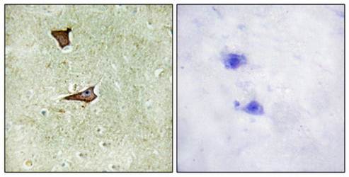 IGF2R (Phospho-Ser2409) Antibody
