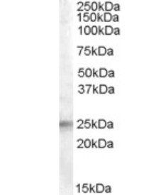 IGFBP6 Antibody