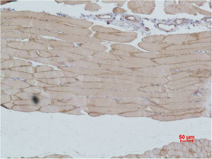IGFN1 Antibody