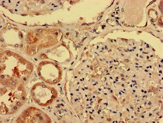 IGHD Antibody