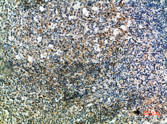 IGHD Antibody