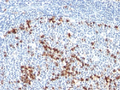 IGKV1D-16 Antibody