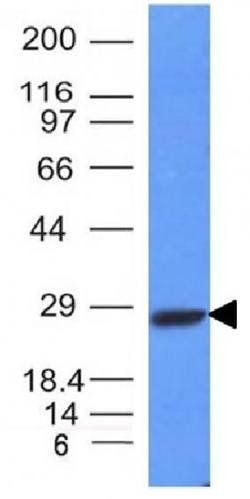 IGKV1D-16 Antibody
