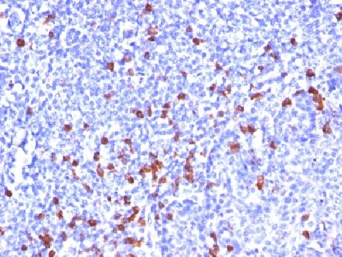 IGKV1D-16 Antibody