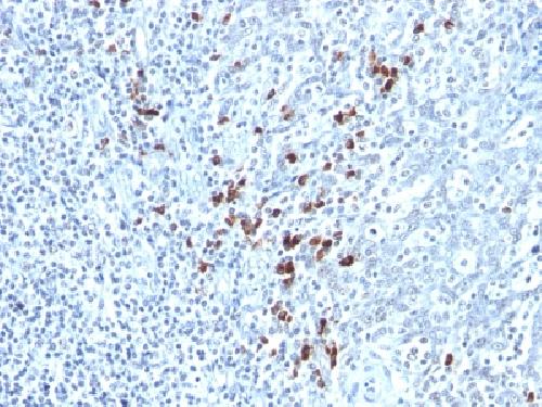 IGKV1D-16 Antibody
