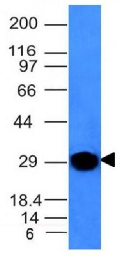 IGKV1D-16 Antibody