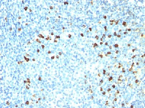 IGKV1D-16 Antibody