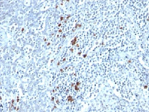 IGKV1D-16 Antibody