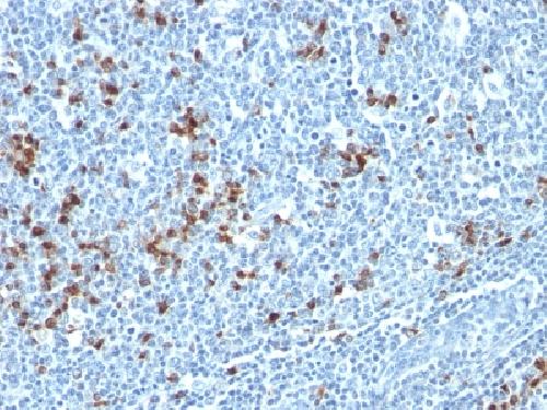 IGKV1D-16 Antibody