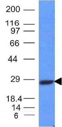 IGKV1D-16 Antibody