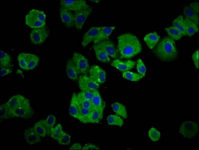 IGKC Antibody