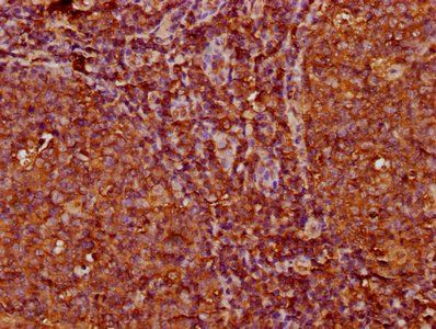 IGKC Antibody