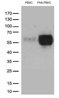 IGSF11 Antibody