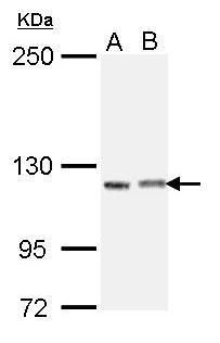 SCIN Rabbit Polyclonal Antibody