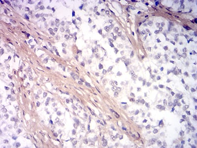 PINK1 Antibody