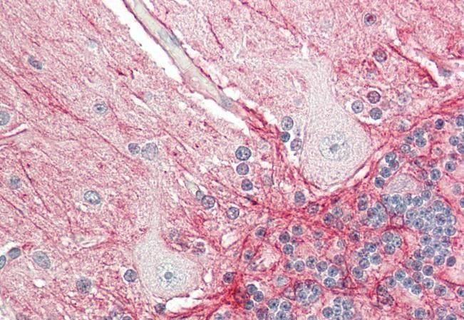 Amyloid beta peptide (mouse) Antibody