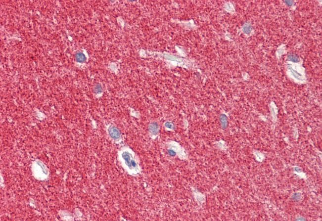 Alpha-synuclein Antibody