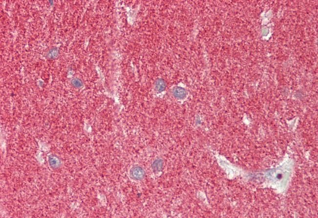 Alpha-synuclein (NACP140) Antibody