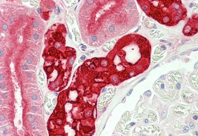 calbindin D28 Antibody