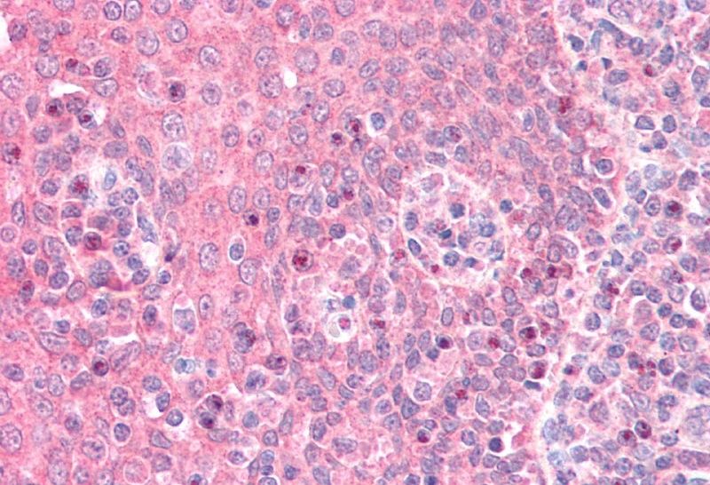 GNAI2 (aa289-299) Antibody