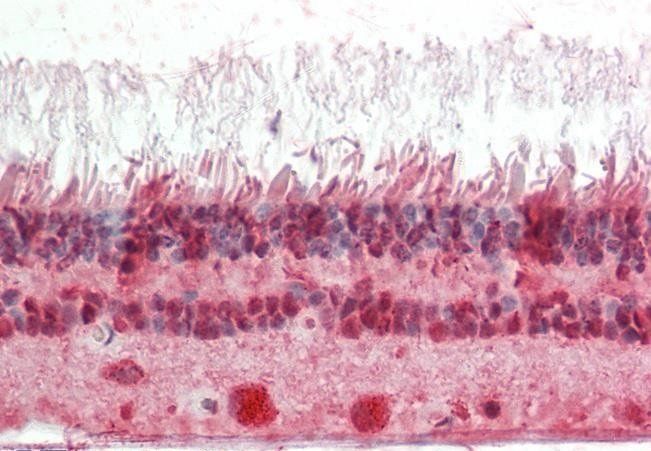 Cone-rod homeobox (C Terminus) Antibody