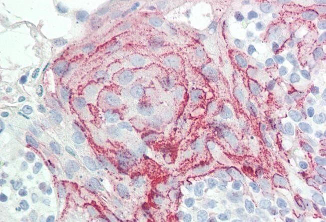 HOXC6 (isoform 1) Antibody