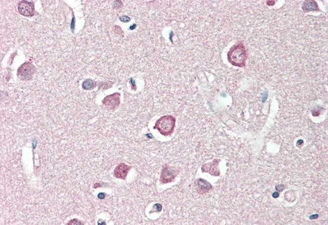 Goat anti-ENPP2 / AUTOTAXIN (aa698-712) Antibody