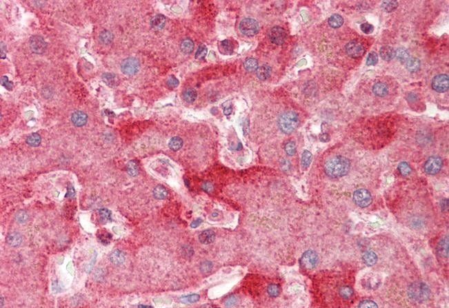 Goat anti-ENPP2 / AUTOTAXIN (aa698-712) Antibody